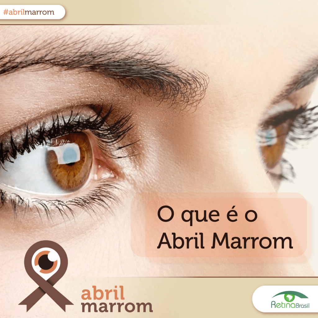 #PraCegoVer imagem do rosto de uma mulher mostrando apenas seus olhos castanhos. Ela está levemente de perfil. Está escrito sobre um apoio de cor alaranjada: "O que é o Abril Marrom". Há uma faixa superior de tom bege em gradiente com a #abrilmarrom escrita e na parte inferior há a mesma faixa de cor bege com a marca do Abril Marrom e a Logo da Retina Brasil.