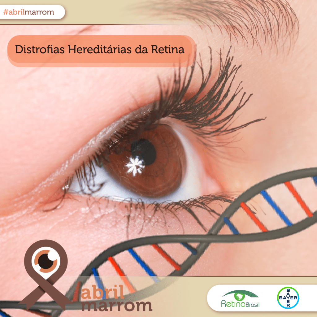 #PraCegoVer imagem de um olho castanho olhando para frente, o olho está de perfil e abaixo a direita há uma representação de um fragmento de filamento de DNA; Está escrito:"Distrofias Hereditárias da Retina" e há a fita do Abril Marrom e as logos da Retina Brasil e da Bayer