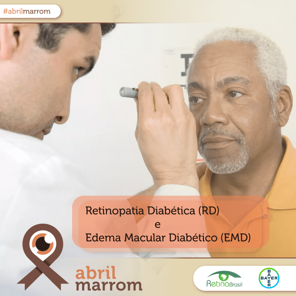 #PraCegoVer imagem de um homem sendo examinado por um oftalmologista. Está escrito: “Retinopatia Diabética (RD) e Edema Macular Diabético (EMD)” Há o laço marrom da Campanha ABril Marrom, a logo da Retina Brasil e logo da @Bayer