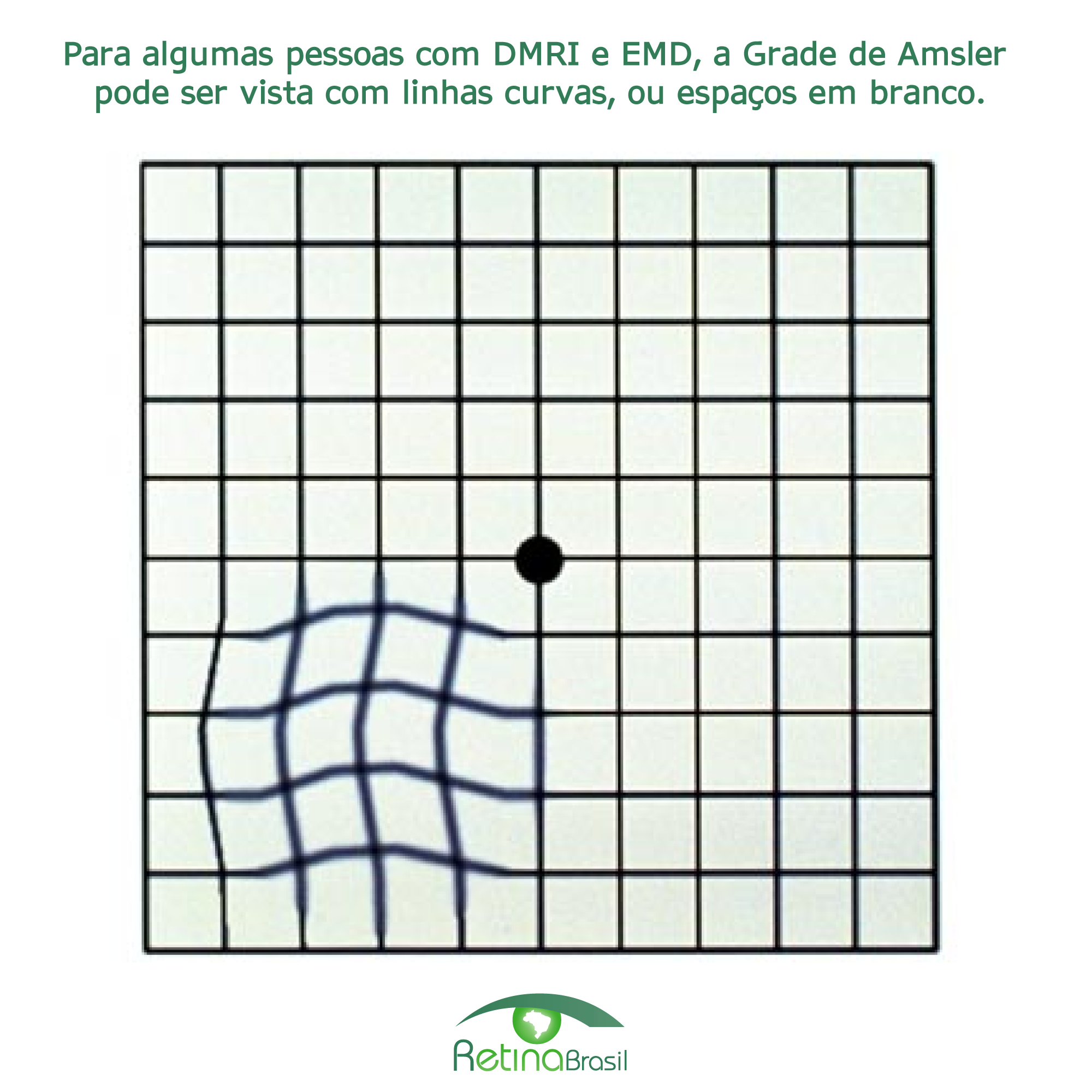 #PraCegoVer Grade de Amsler exemplificando uma alteração.