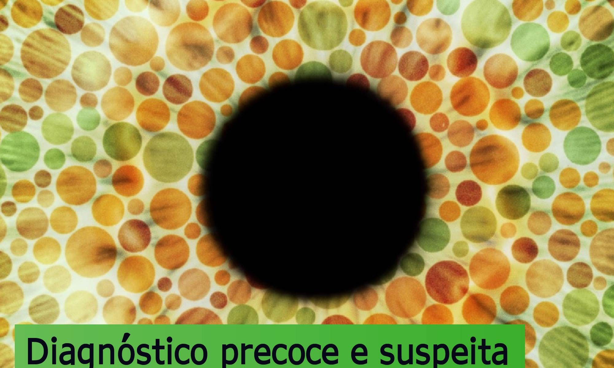 imagem estilizada que simula um olho em um teste de visão de cores. Está escrito: "Diagnóstico precoce e suspeita clínica das Doenças Hereditárias da Retina (DHRs)" e há a logo da Retina Brasil.