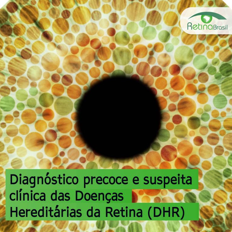 imagem estilizada que simula um olho em um teste de visão de cores. Está escrito: "Diagnóstico precoce e suspeita clínica das Doenças Hereditárias da Retina (DHRs)" e há a logo da Retina Brasil.